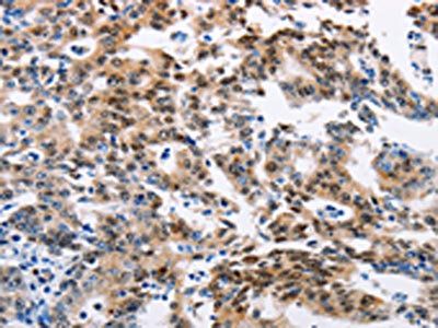 ACVR1B antibody