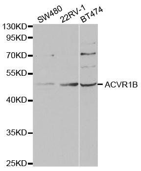 ACVR1B antibody