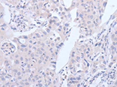 ACVR1C antibody