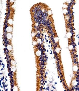ACVRL1 antibody