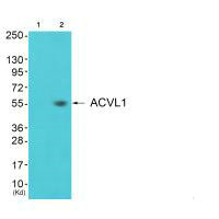 ACVRL1 antibody