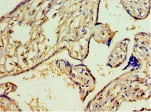 ACY1 antibody