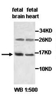 ACYP1 Rabbit Polyclonal Antibody