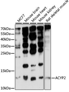 ACYP2 antibody