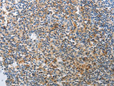 AD7C-NTP antibody