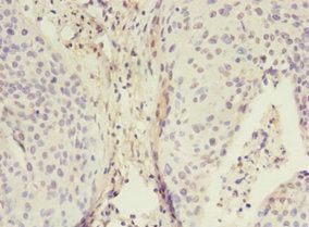 ADA Antibody