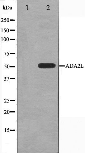 ADA2L antibody