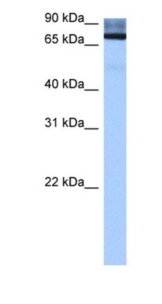 ADAD2 antibody