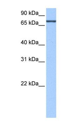 ADAD2 antibody