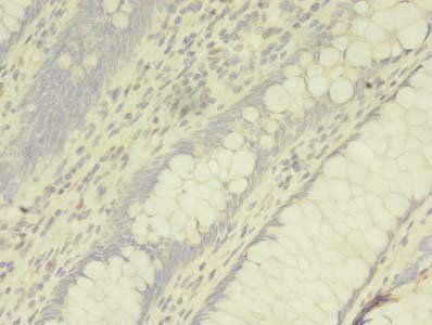 ADAM10 Antibody