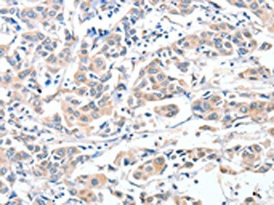 ADAM10 Antibody