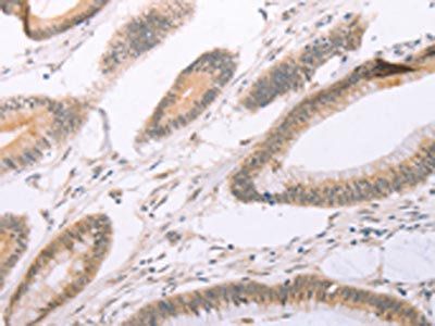 ADAM11 Antibody