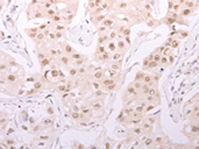 ADAM12 Antibody
