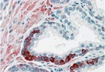 Goat anti-ADAM12 Antibody