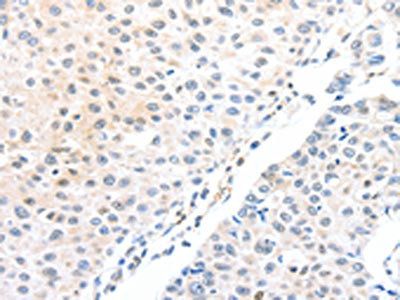ADAM15 Antibody