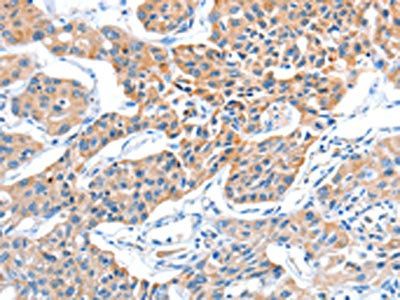 ADAM15 Antibody