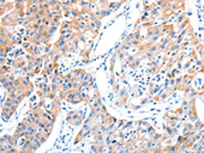 ADAM17 Antibody