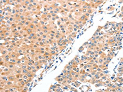 ADAM2 Antibody