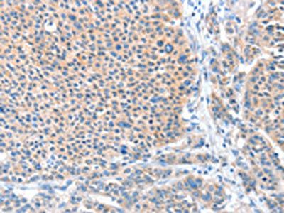 ADAM20 Antibody