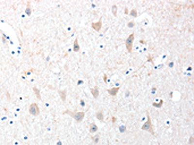 ADAM20 Antibody