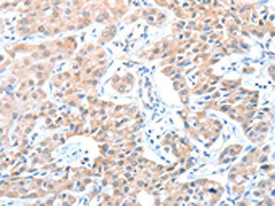 ADAM21 Antibody