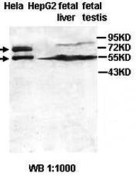 ADAM21 Rabbit Polyclonal Antibody