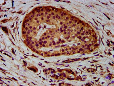 ADAM23 Antibody