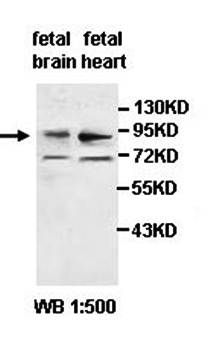 ADAM23 Rabbit Polyclonal Antibody
