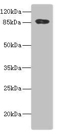 ADAM28 antibody