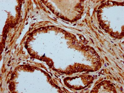 ADAM29 Antibody