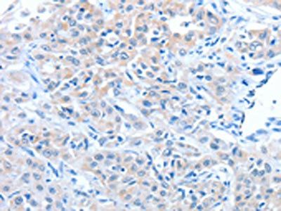 ADAM7 Antibody
