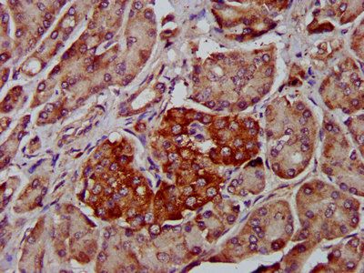 ADAM8 Antibody