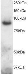 Goat anti-MS2 / ADAM8 / CD156 Antibody