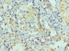 ADAM9 Antibody