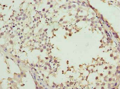 ADAMTS12 Antibody