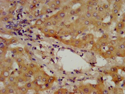 ADAMTS13 Antibody