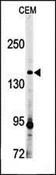 ADAMTS13 antibody