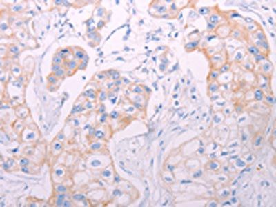 ADAMTS14 Antibody