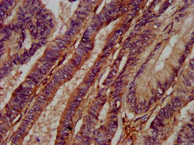 ADAMTS15 Antibody