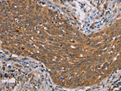 ADAMTS15 Antibody