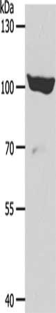 ADAMTS15 antibody