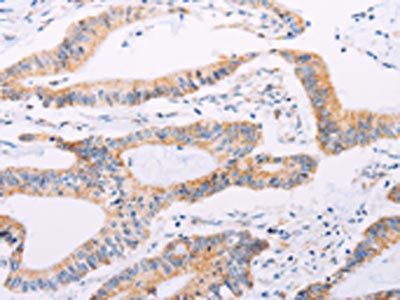 ADAMTS16 Antibody