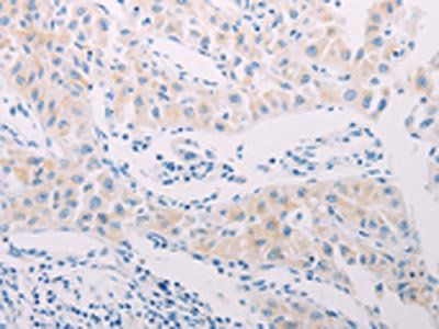 ADAMTS17 Antibody