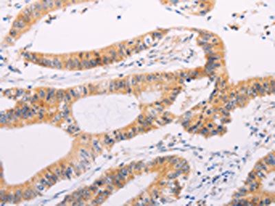 ADAMTS17 Antibody