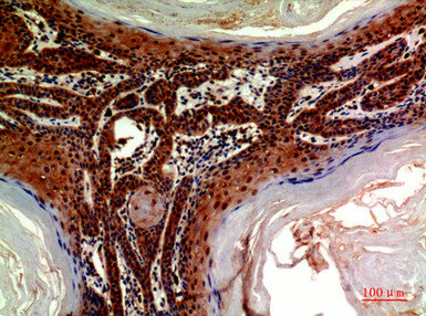 ADAMTS18 Antibody