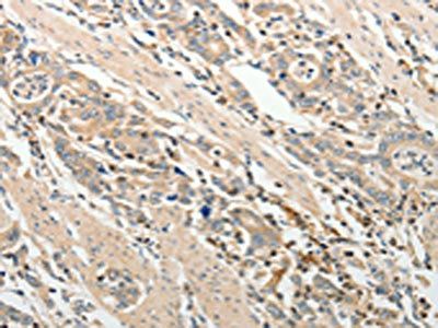 ADAMTS2 Antibody