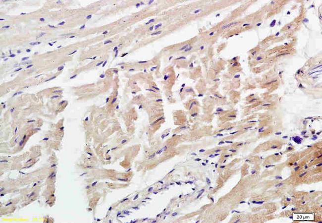 ADAMTS2 Rabbit Polyclonal Antibody