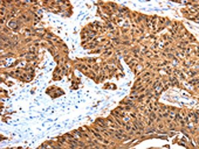 ADAMTS5 Antibody