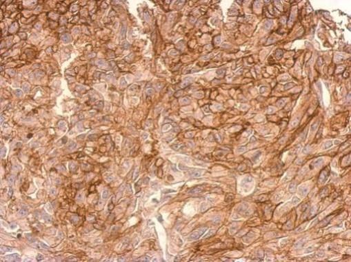 ADAMTSL2 antibody [C3], C-term