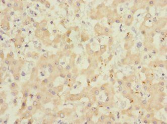 ADAMTSL4 Antibody